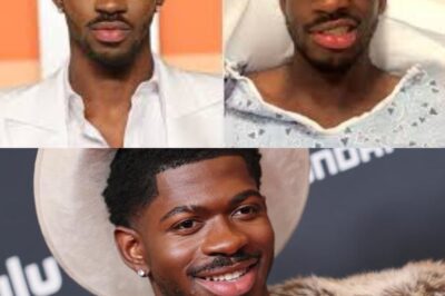 Lil Nas X Faces Health Struggle After Losing Control of One Side of His Face: What We Know So Far (NH)